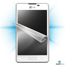ScreenShield LG E460 Optimus L5 II - Film for display protection
